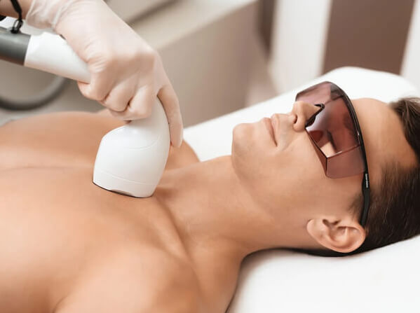 laser hair removal for men laser hair removal for men