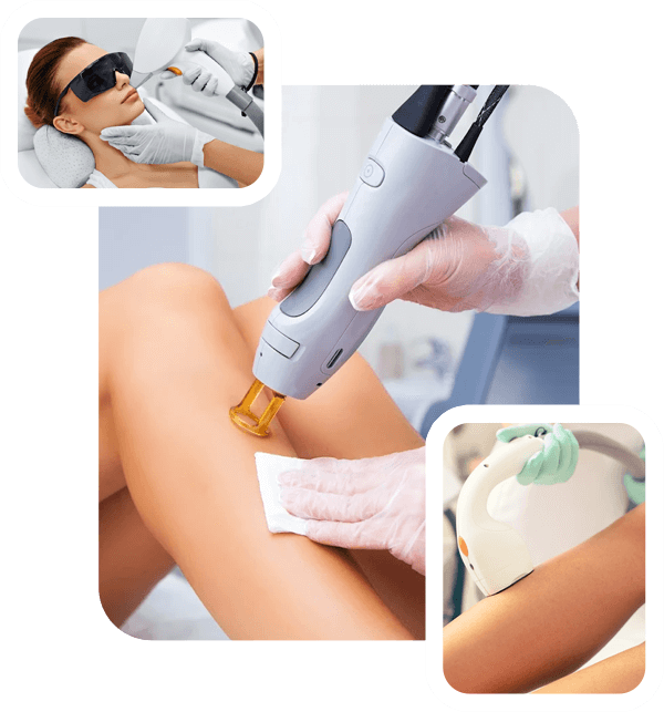 laser hair removal Toronto laser hair removal Toronto